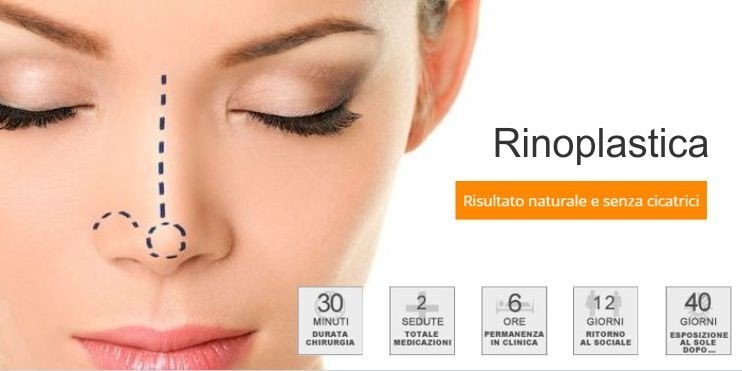 Rinoplastica Avellino Costo-Rinoplastica Costo Rinoplastica Rinoplastica Avellino  